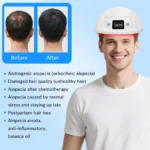 XHUIA Laser Hair Growth Helmet 448 Diodes, 650nm LLLT Cap - Image 3