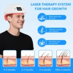 XHUIA Laser Hair Growth Helmet 448 Diodes, 650nm LLLT Cap - Image 2