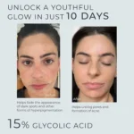 InstaSkincare Glycolic Acid Facial Serum 60ml 15% AHA Exfoliating - Image 4